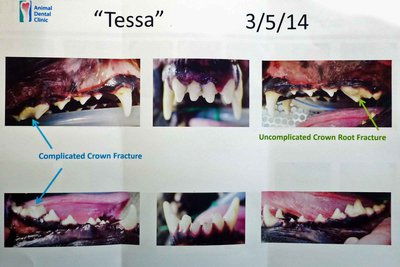 3.3.14-tessa.teeth1.jpg